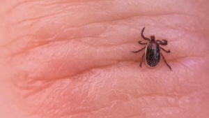 Tick Bite Paralyzes Fitness Influencer: A Warning About Outdoor Dangers and Hidden Infections