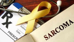 Don’t ignore painless lumps: How sarcoma differs from breast, lung, and colon cancer