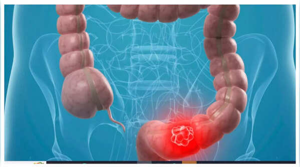 Person holding abdomen in pain.