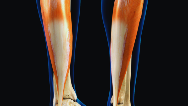 Illustration of the soleus muscle location in the leg.