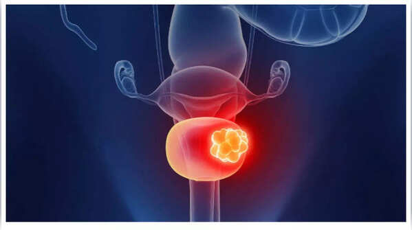 Lower back pain as a sign