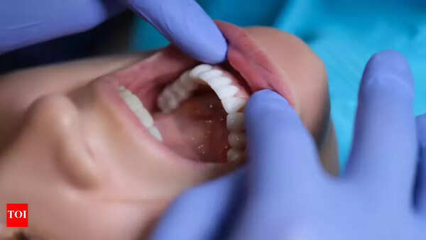 Oral Cancer: Spotting the Signs, Understanding the Risks, and Why Early Detection Can Be Life-Saving