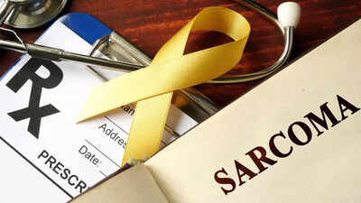 Don’t ignore painless lumps: How sarcoma differs from breast, lung, and colon cancer
